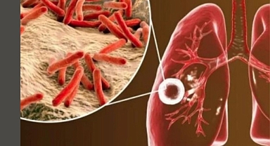Verem Eğitimi ve Farkındalık Haftası Başladı